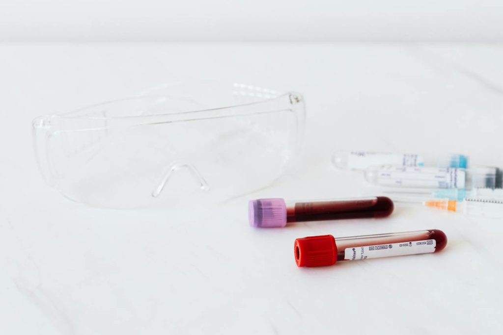 tsh-with-reflex-to-free-t4.jpg